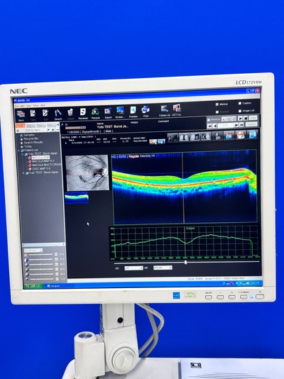High-performance SD-OCT at the best price for private practitioners. — Nidek RS-3000 Lite&nbsp;|&nbsp;NIDEK&nbsp;|&nbsp;RS-3000 Lite