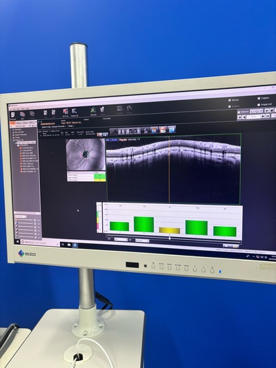 12-megapixel fundus photography × ultra-high-definition OCT&nbsp;|&nbsp;NIDEK&nbsp;|&nbsp;RS-330 Retina Scan Duo