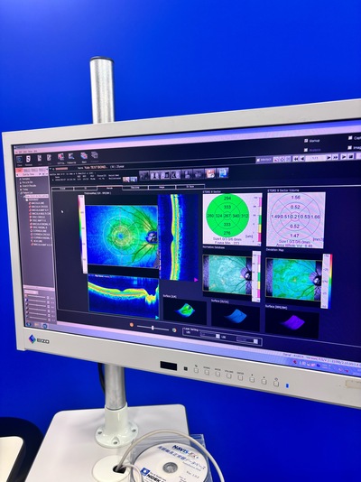 ANGIOGRAPHY Installed. No injections required. An unprecedented, high-definition 3D map of retinal blood flow drawn with light.&nbsp;|&nbsp;NIDEK&nbsp;|&nbsp;RS-3000 Advance