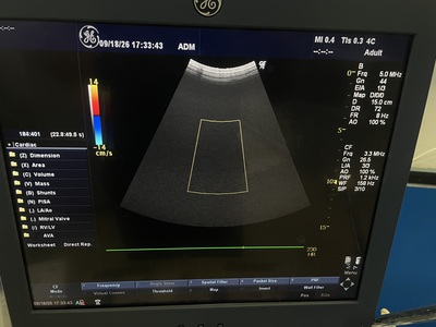 Color Doppler&nbsp;|&nbsp;GE&nbsp;|&nbsp;LOGIQ P6