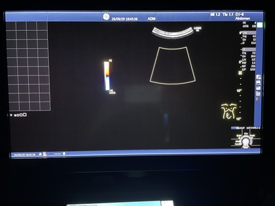 Color Doppler&nbsp;|&nbsp;GE&nbsp;|&nbsp;Logiq S8 XDclear