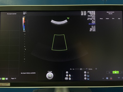 4D Ultrasound&nbsp;|&nbsp;GE&nbsp;|&nbsp;Voluson E10 BT19