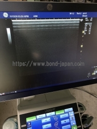 超音波診断装置&nbsp;|&nbsp;GEヘルスケア・ジャパン株式会社&nbsp;|&nbsp;LOGIQ P7の写真