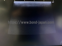 Color Doppler&nbsp;|&nbsp;GE&nbsp;|&nbsp;Logiq S7 Expert XDclear