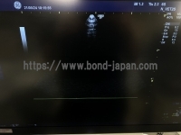 超音波診断装置&nbsp;|&nbsp;GEヘルスケア・ジャパン株式会社&nbsp;|&nbsp;LOGIQ P7の写真