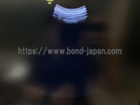 4D Ultrasound&nbsp;|&nbsp;GE&nbsp;|&nbsp;Voluson S8