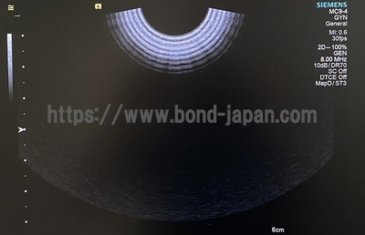 超音波診断装置&nbsp;|&nbsp;持田シーメンスメディカルシステム株式会社&nbsp;|&nbsp;Acuson S1000の写真