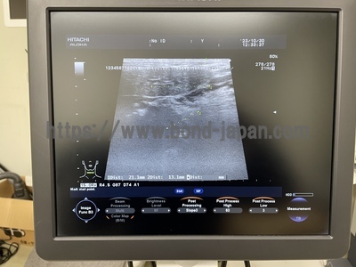 Color Doppler&nbsp;|&nbsp;HITACHI&nbsp;|&nbsp;F37