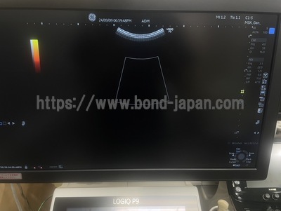 Ultrasound&nbsp;|&nbsp;GE&nbsp;|&nbsp;LOGIQ P9