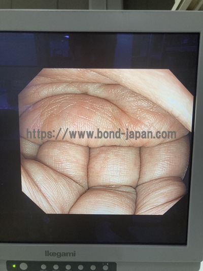 Video Gastroscope&nbsp;|&nbsp;OLYMPUS&nbsp;|&nbsp;GIF-HQ290