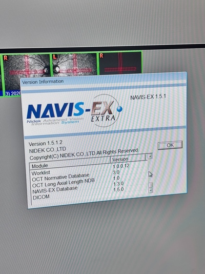 OCT with Fundus function&nbsp;|&nbsp;NIDEK&nbsp;|&nbsp;RS-3000 Advance