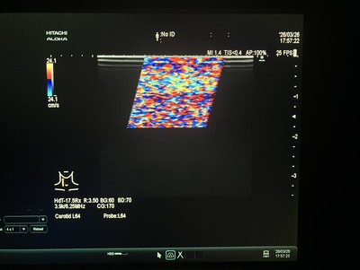 Ultrasound System&nbsp;|&nbsp;HITACHI&nbsp;|&nbsp;ARIETTA 60