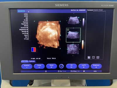 Color Doppler&nbsp;|&nbsp;SIEMENS&nbsp;|&nbsp;X300 PE
