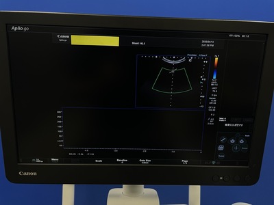 Ultrasound System&nbsp;|&nbsp;CANON&nbsp;|&nbsp;Aplio Go