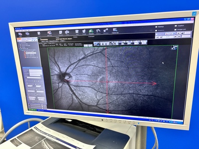 OCT with Fundus function&nbsp;|&nbsp;NIDEK&nbsp;|&nbsp;RS-3000