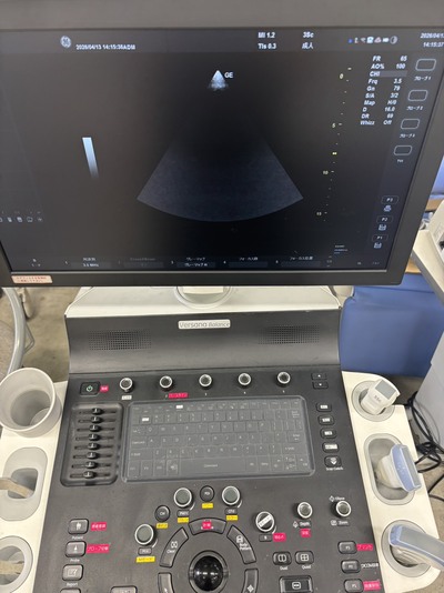 超音波診断装置&nbsp;|&nbsp;GEヘルスケア・ジャパン株式会社&nbsp;|&nbsp;Versana Balanceの写真