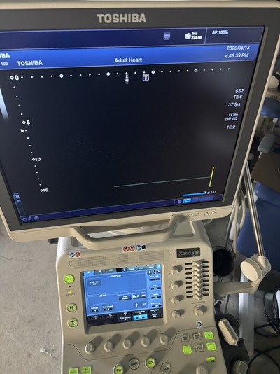 Color Doppler&nbsp;|&nbsp;CANON&nbsp;|&nbsp;TUS-X100 Xario 100