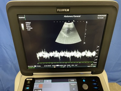 Portable Ultrasound&nbsp;|&nbsp;FUJIFILM&nbsp;|&nbsp;FC1-X