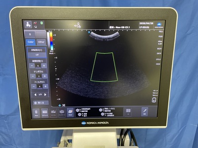 Ultrasound System&nbsp;|&nbsp;konica&nbsp;|&nbsp;SONOVISTA GX20