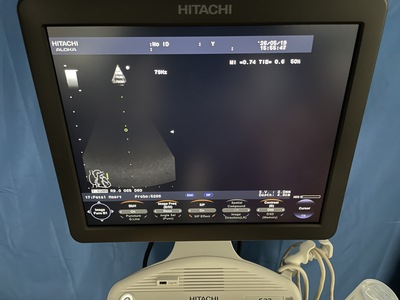 Color Doppler&nbsp;|&nbsp;HITACHI&nbsp;|&nbsp;F37
