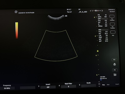 Ultrasound&nbsp;|&nbsp;GE&nbsp;|&nbsp;Versana Active