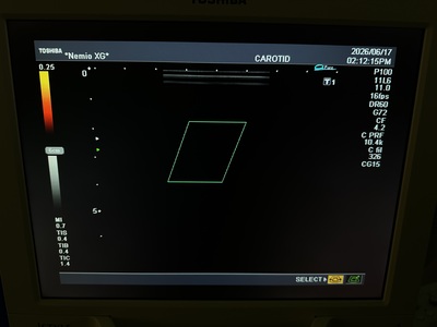 Color Doppler&nbsp;|&nbsp;CANON&nbsp;|&nbsp;SSA-580A Nemio XG