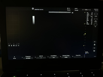 Portable Color doppler&nbsp;|&nbsp;GE&nbsp;|&nbsp;Versana Active