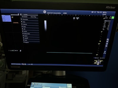 Color Doppler&nbsp;|&nbsp;GE&nbsp;|&nbsp;Logiq S8 XDclear