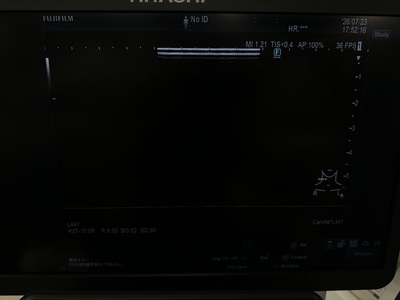 Ultrasound&nbsp;|&nbsp;FUJIFILM&nbsp;|&nbsp;ARIETTA 850SE