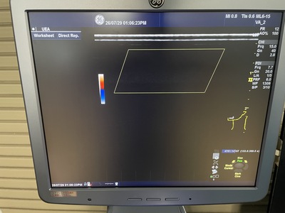 Color Doppler&nbsp;|&nbsp;GE&nbsp;|&nbsp;Logiq S7 Expert