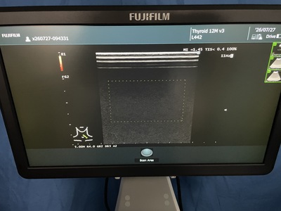 Ultrasound System&nbsp;|&nbsp;FUJIFILM&nbsp;|&nbsp;ARIETTA 50
