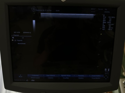 Color Doppler&nbsp;|&nbsp;GE&nbsp;|&nbsp;LOGIQ P5