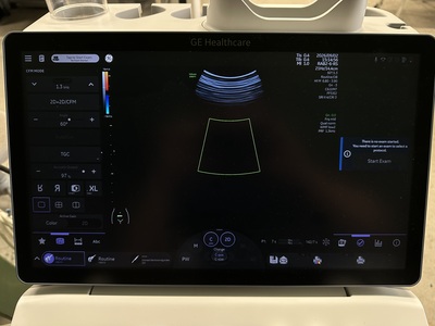 4D Ultrasound&nbsp;|&nbsp;GE&nbsp;|&nbsp;Voluson Swift BT23