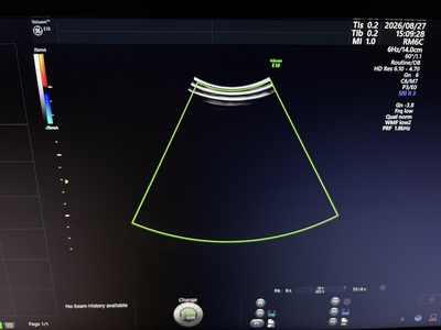 4D Ultrasound&nbsp;|&nbsp;GE&nbsp;|&nbsp;Voluson E10 BT20