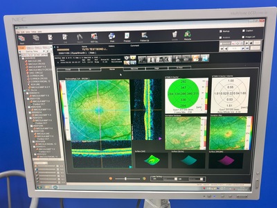 Fully Refurbished OCT with Angiography + Anterior Lens kit&nbsp;|&nbsp;NIDEK&nbsp;|&nbsp;RS-3000 Advance