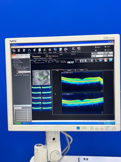 High-performance SD-OCT at the best price for private practitioners. — Nidek RS-3000 Lite&nbsp;|&nbsp;NIDEK&nbsp;|&nbsp;RS-3000 Lite