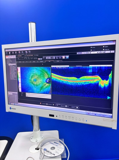 ANGIOGRAPHY Installed. No injections required. An unprecedented, high-definition 3D map of retinal blood flow drawn with light.&nbsp;|&nbsp;NIDEK&nbsp;|&nbsp;RS-3000 Advance