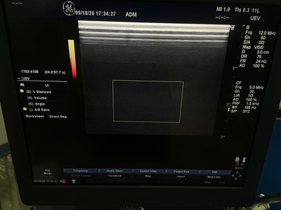 Color Doppler&nbsp;|&nbsp;GE&nbsp;|&nbsp;LOGIQ P6