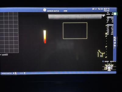 Color Doppler&nbsp;|&nbsp;GE&nbsp;|&nbsp;Logiq S8 XDclear