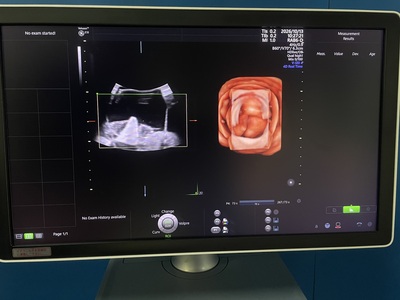 4D Ultrasound&nbsp;|&nbsp;GE&nbsp;|&nbsp;Voluson E10 BT19