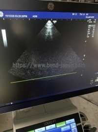 超音波診断装置&nbsp;|&nbsp;GEヘルスケア・ジャパン株式会社&nbsp;|&nbsp;LOGIQ P7の写真