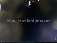 Color Doppler&nbsp;|&nbsp;GE&nbsp;|&nbsp;Logiq S7 Expert XDclear