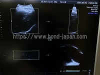 4D Ultrasound&nbsp;|&nbsp;GE&nbsp;|&nbsp;Voluson S8