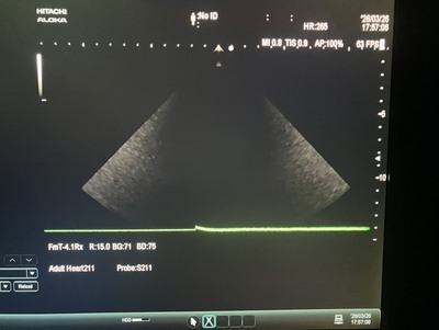 Ultrasound System&nbsp;|&nbsp;HITACHI&nbsp;|&nbsp;ARIETTA 60