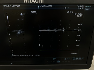 Ultrasound&nbsp;|&nbsp;HITACHI&nbsp;|&nbsp;Arietta 65