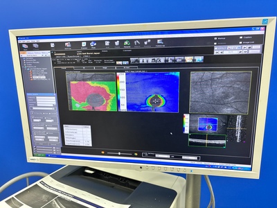 OCT with Fundus function&nbsp;|&nbsp;NIDEK&nbsp;|&nbsp;RS-3000
