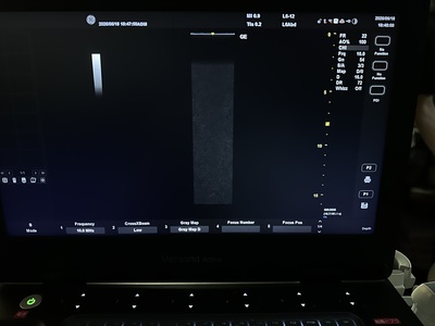 Ultrasound&nbsp;|&nbsp;GE&nbsp;|&nbsp;Versana Active