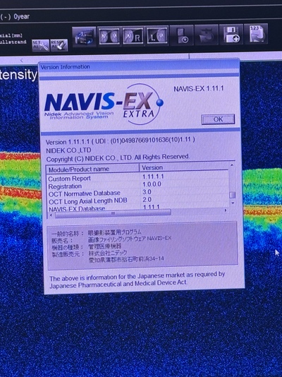 Advanced OCT + Fundus camera&nbsp;|&nbsp;NIDEK&nbsp;|&nbsp;RS-330 Retina Scan Duo