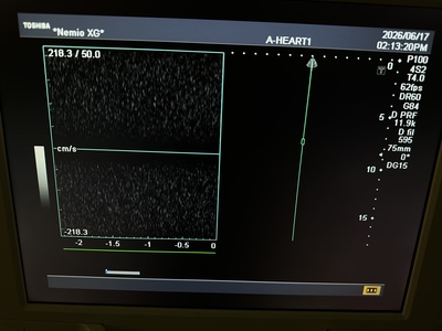 Color Doppler&nbsp;|&nbsp;CANON&nbsp;|&nbsp;SSA-580A Nemio XG