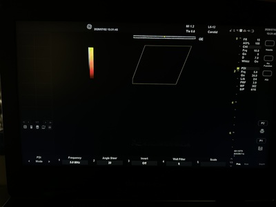 Portable Color doppler&nbsp;|&nbsp;GE&nbsp;|&nbsp;Versana Active
